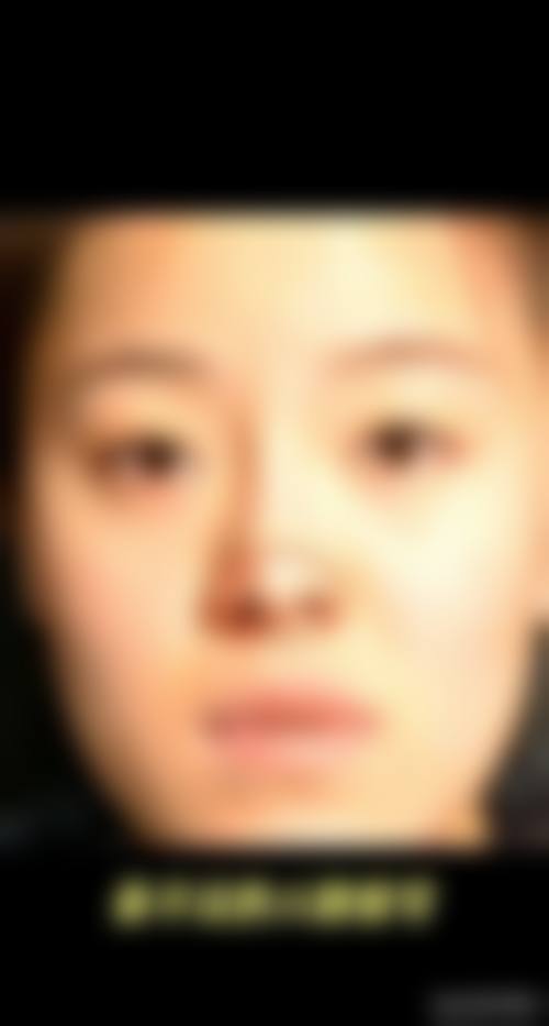 董涵域医生的技术特色与安心保护