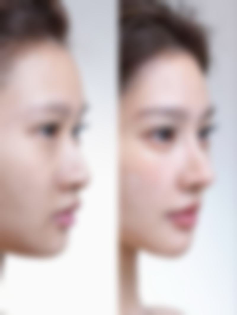 泰国TARA CLINIC整形来院路线