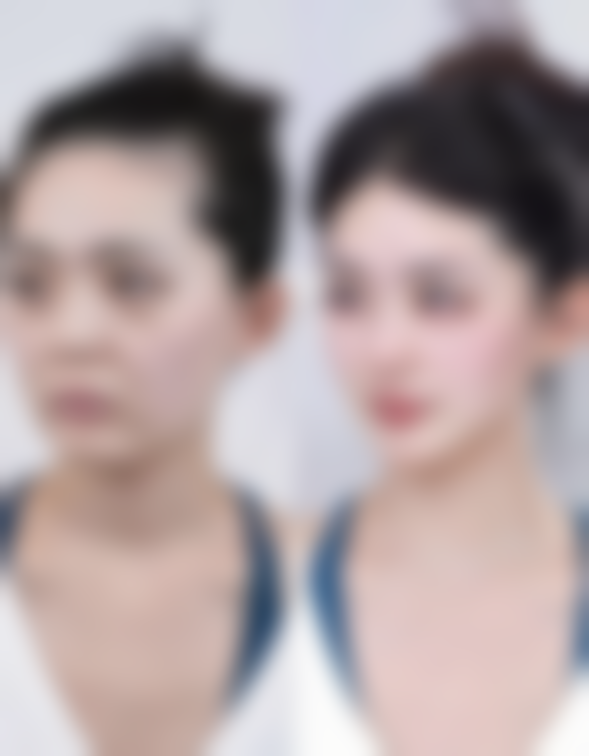 成都壹心环亚医疗美容医院价格收费