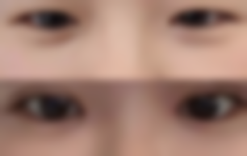 徐州心源整形美容医院价格收费