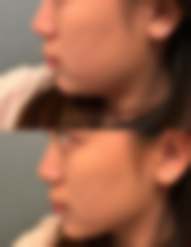 王冰院长：23年从业经验的面部年轻化注射微雕大师