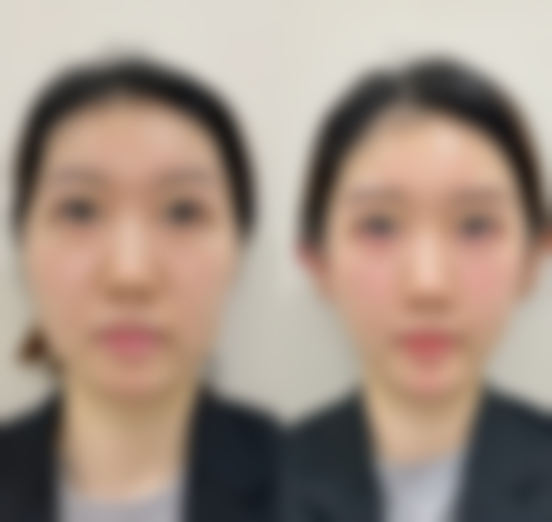 宁乡韩美医疗美容门诊部价格收费