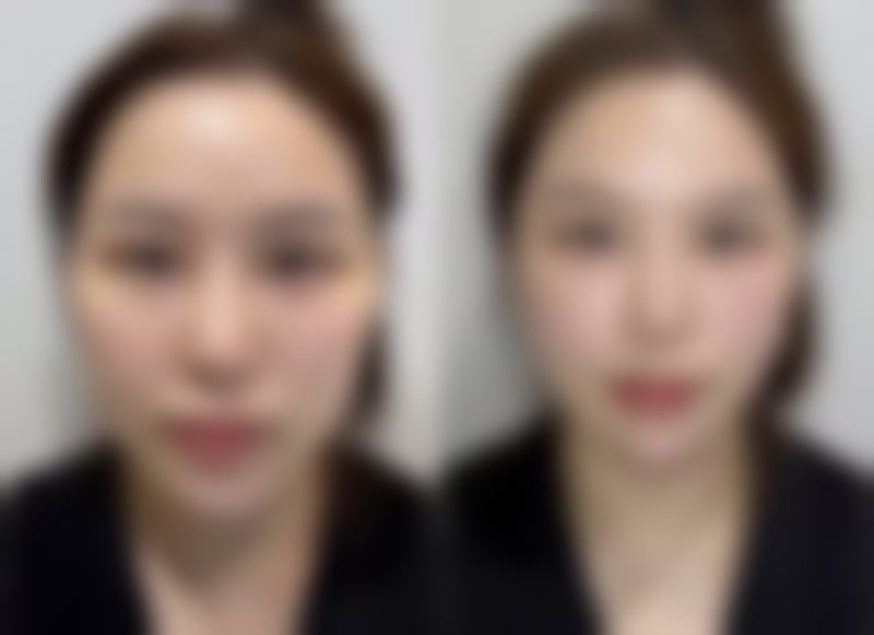 成都壹心环亚医疗美容医院求美者反馈