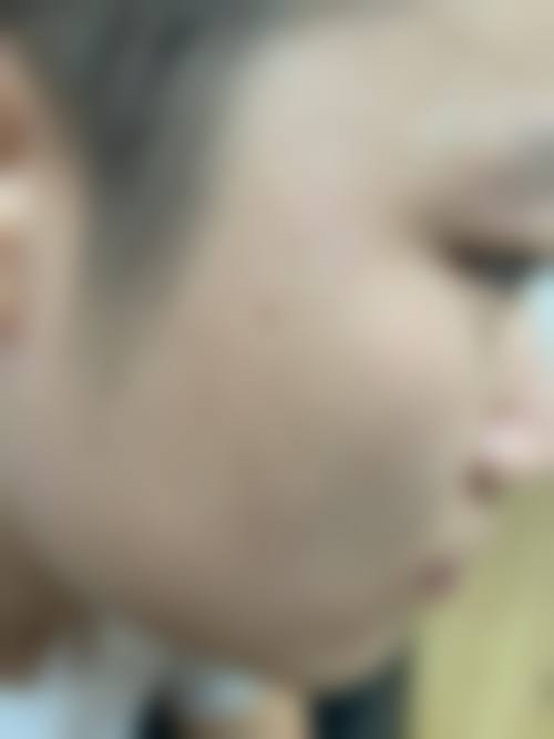 求美者真实反馈