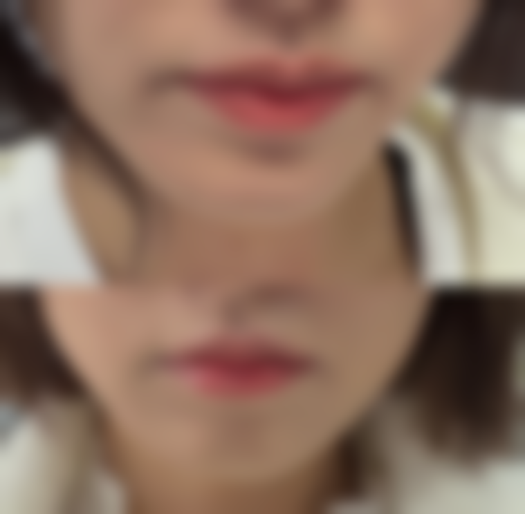 求美者真实反馈