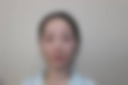 潘丽红接诊项目全览:覆盖日常医美到复杂整形需求