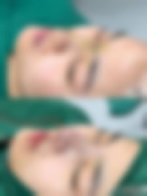 求美者真实反馈