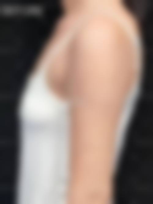 潘丽红:专注面部年轻化与脂肪抽吸填充核心领域