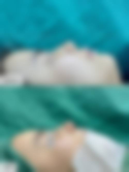 求美者真实反馈