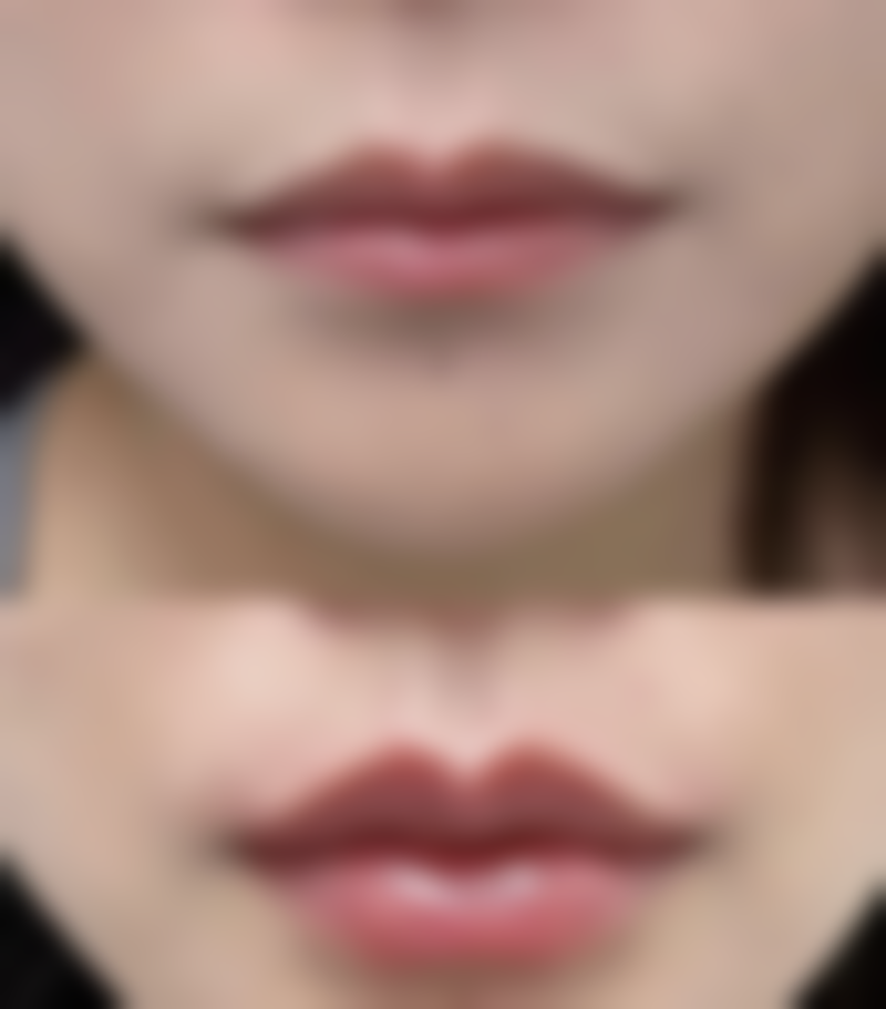 胡晗菲医师遵循衡阳美莱品质服务标准