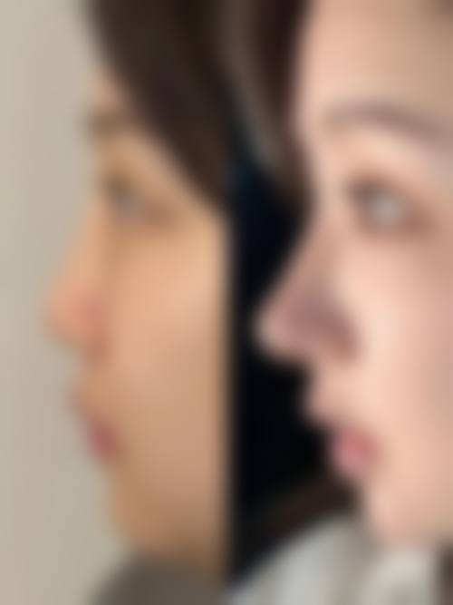 求美者真实反馈