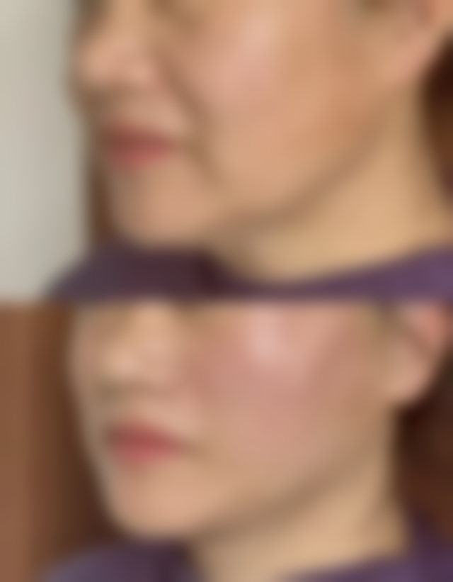 求美者真实反馈