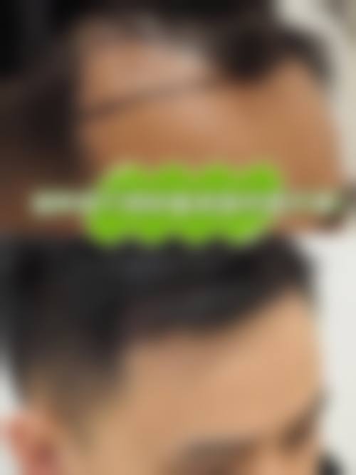 汪方医生覆盖全方面的医美擅长领域