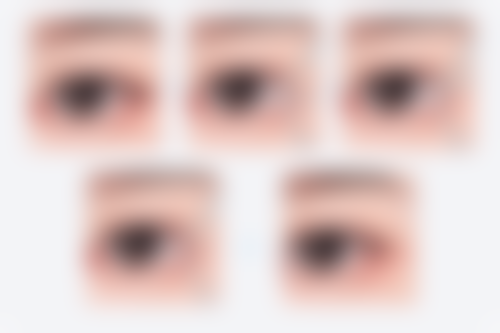 历芳医师的眼部整形优势：打造灵动自然的眼部形态