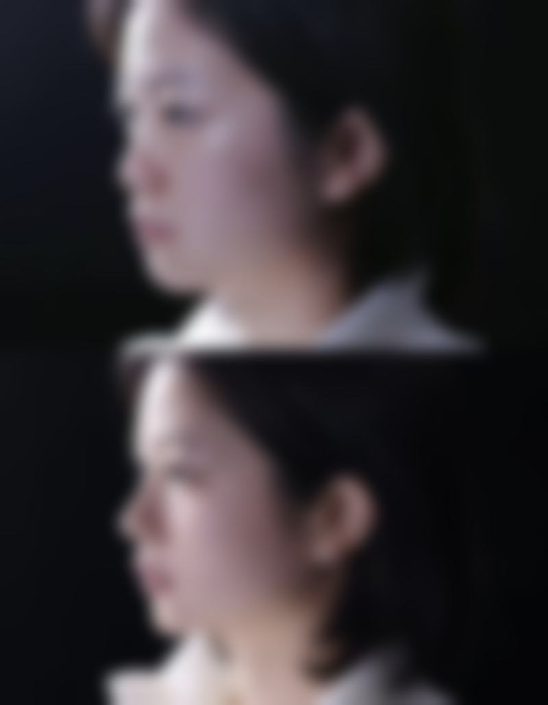 求美者真实反馈