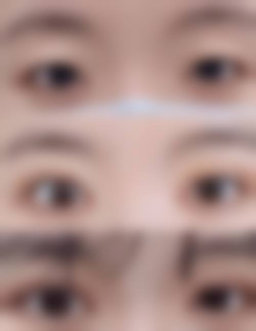 袁天华医生的个性化医美服务特色