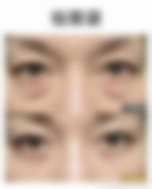 陈泽坚持安心合规的医美服务标准