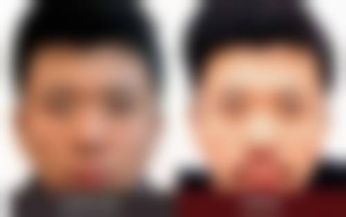 顾维新专精眼鼻美容手术:精细化打造自然灵动的容貌