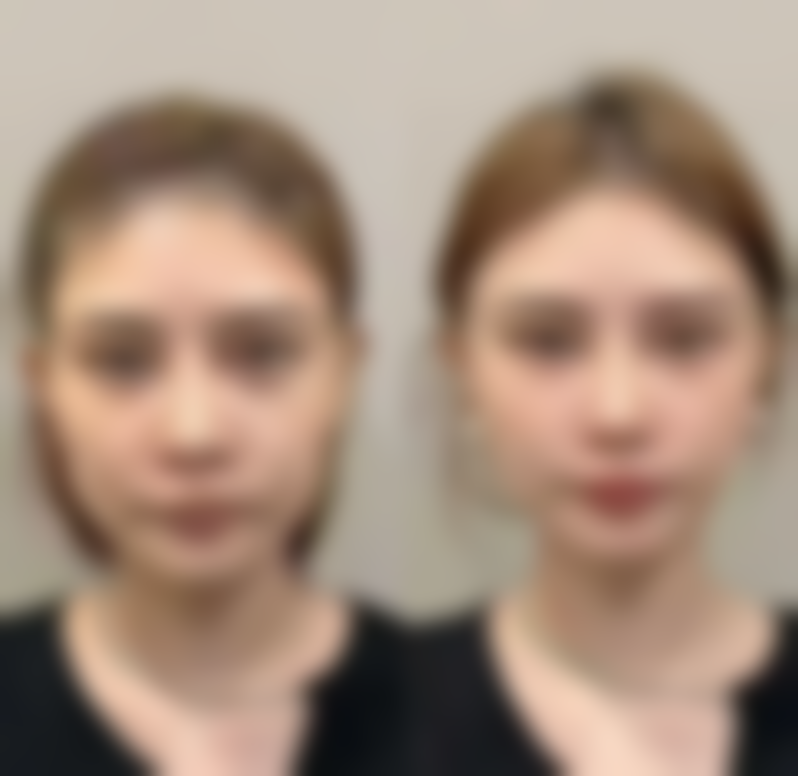 求美者真实反馈