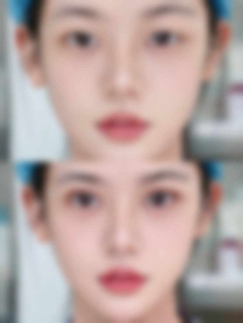 求美者真实反馈