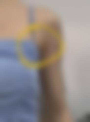 杨季涛覆盖全品类的医美临床擅长领域