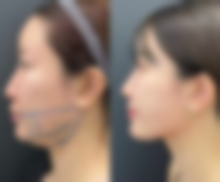 求美者真实反馈