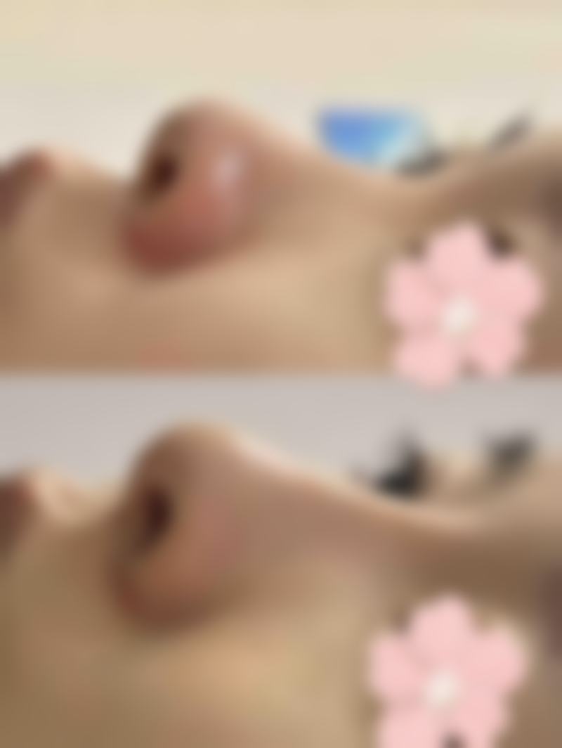 求美者真实反馈