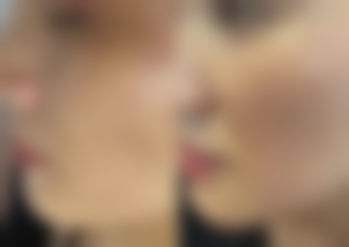 求美者真实反馈