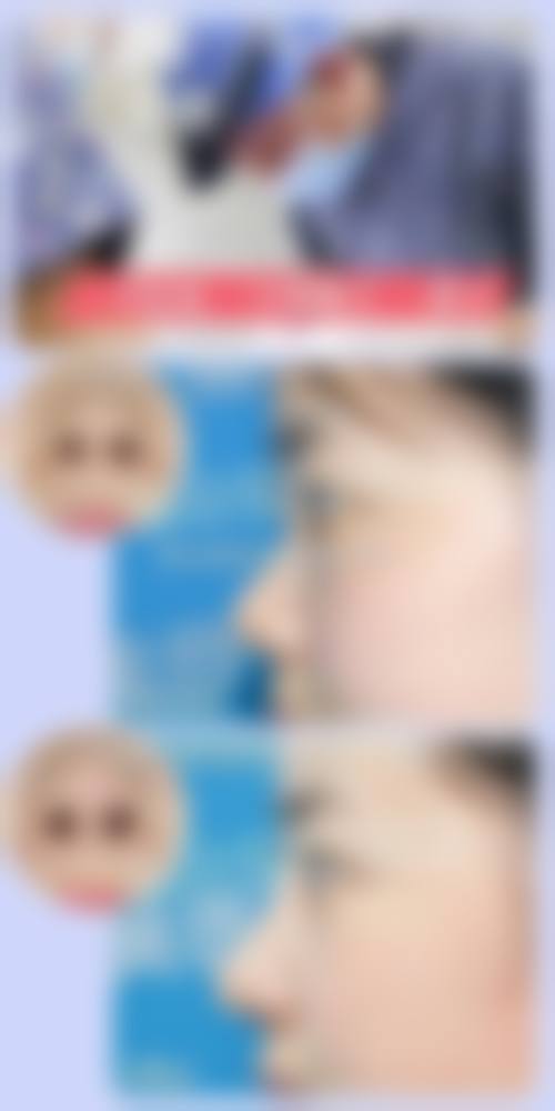 林祥医生的个性化审美与诊疗标准