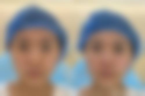 求美者真实反馈