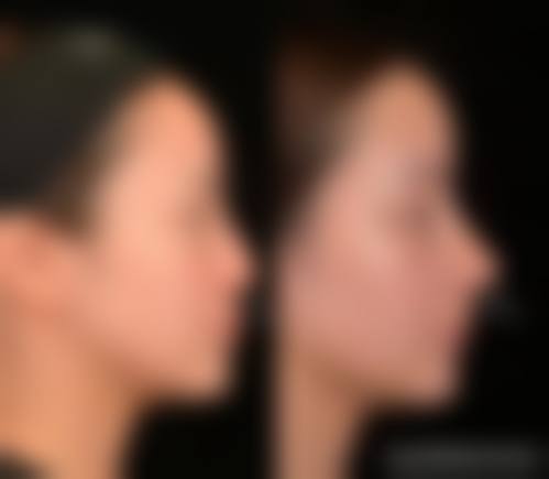 文诚浩医师的个性化诊疗理念