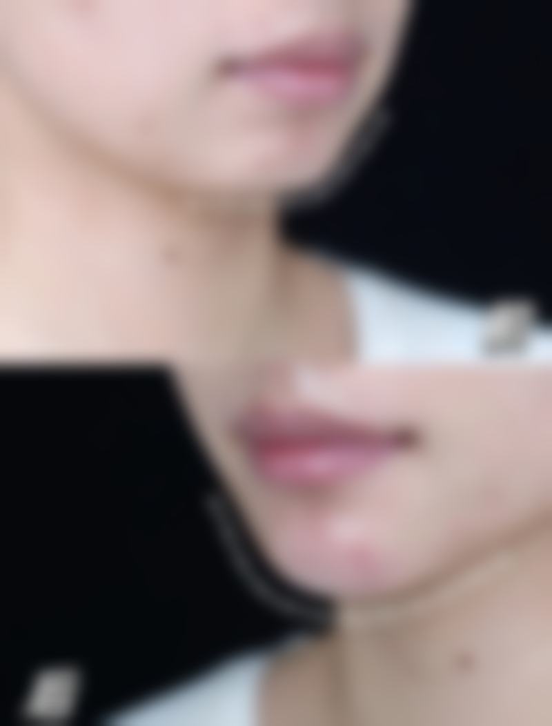 求美者真实反馈