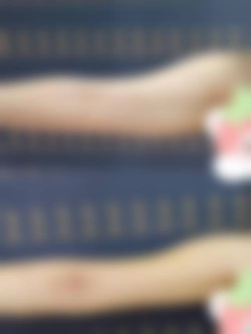 郑方荣医生：覆盖全品类医美项目，满足多元变得更美需求