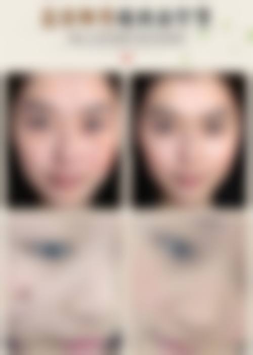 陈守明个性化医美方案的定制原则