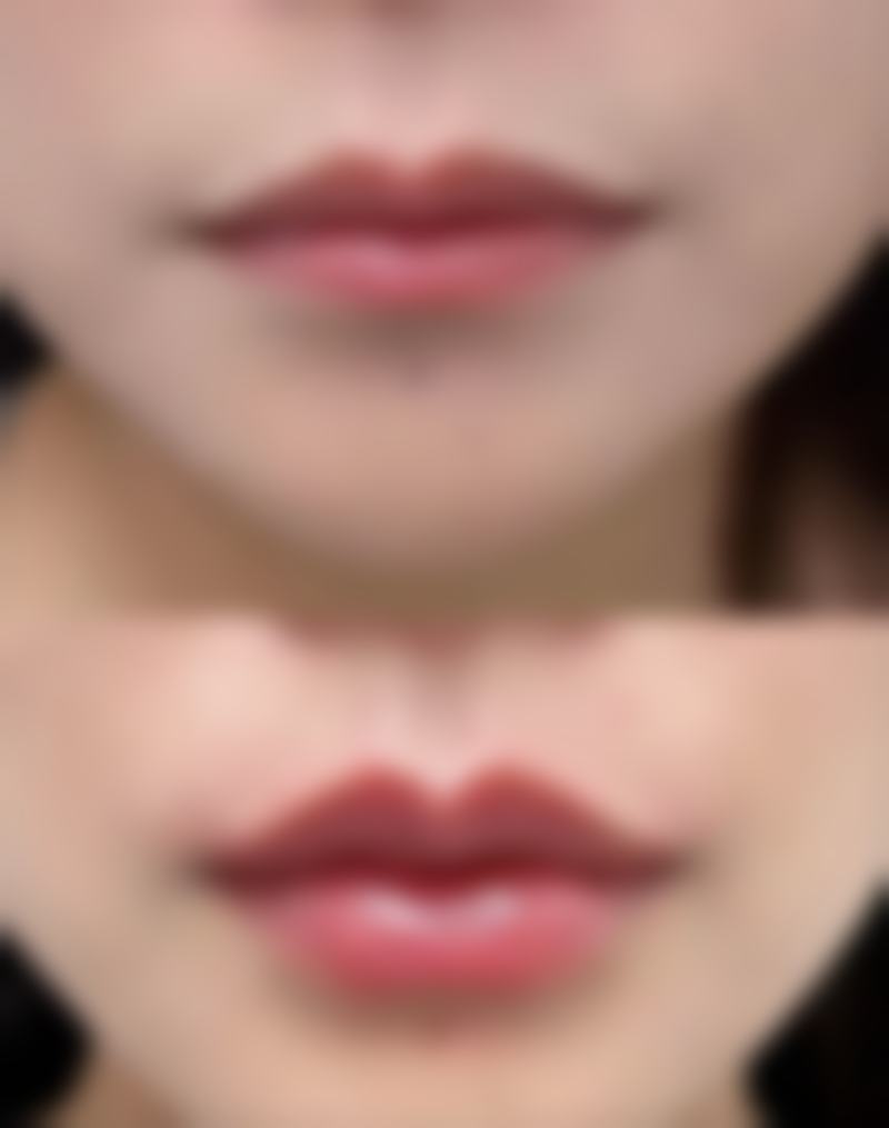 求美者真实反馈