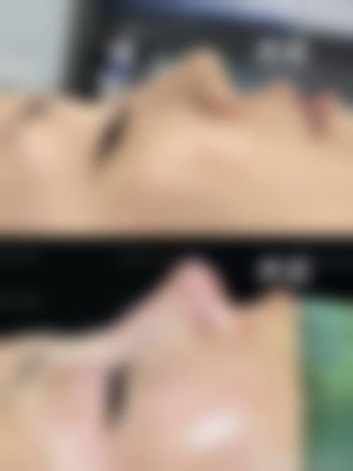 求美者真实反馈