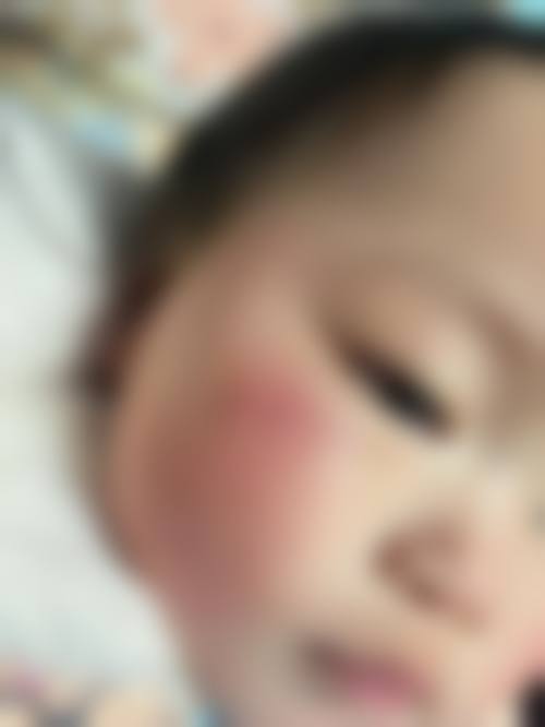 尹林践行的精细化医美服务标准