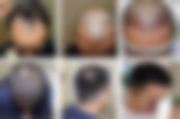 依托专精连锁平台,曹昌虹医生的诊疗有多重保护