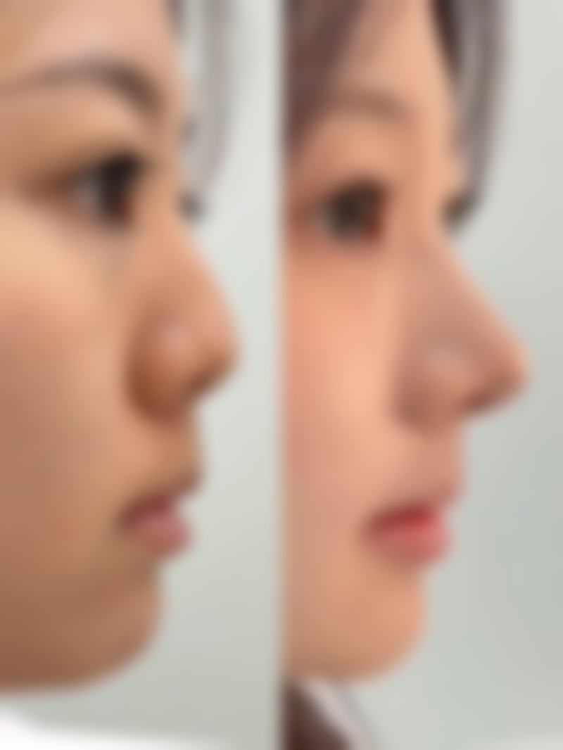 求美者真实反馈