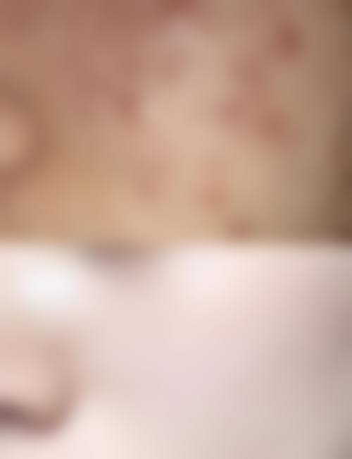 便捷预约渠道，轻松对接陈艳芳医生面诊