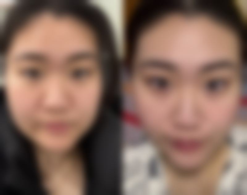 贵阳铭逸整形医院价格收费