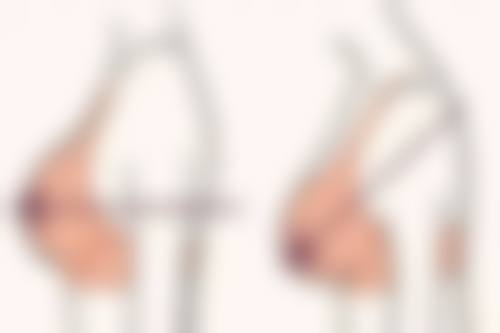 东莞星妃整形医疗美容门诊部特色项目及技术优势