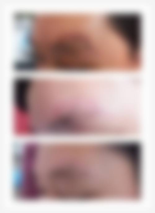 上海市第七人民医院烧伤整形门诊部求美者反馈