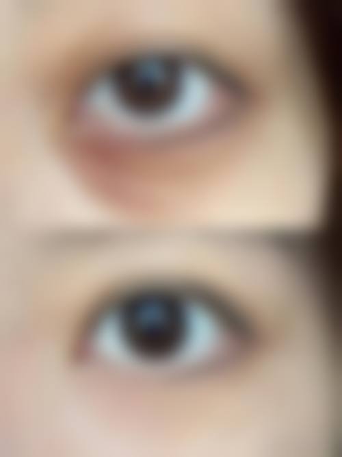 昆明吉美整形医疗美容诊所来院路线