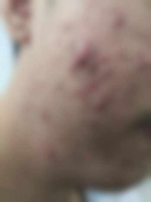 太原九州皮肤病医院简介概述