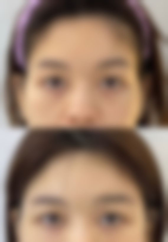 带广SkinClinic求美者反馈