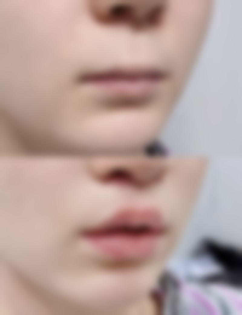 枣庄纹艺医疗美容诊所特色项目及技术优势