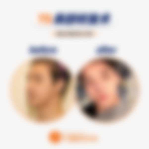 韩国TS整形外科医院来院路线