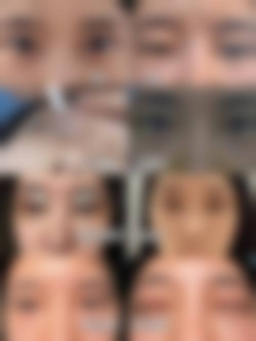 湖北恩施美年华整形医院价格收费