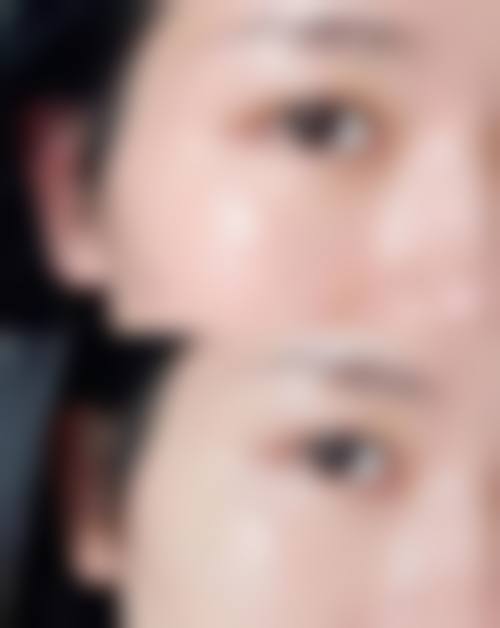 闫平行坐诊的安徽韩美整形专属优势